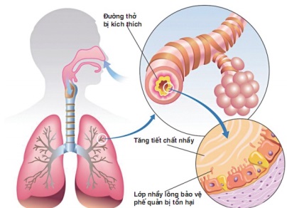 biến chứng do viêm phế quản mạn tính