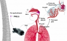 Ô nhiễm không khí vượt ngưỡng, cần làm gì để bảo vệ sức khỏe hô hấp?
