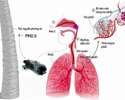 Làm gì bảo vệ phổi khi không khí ô nhiễm?