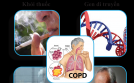 Sát thủ vô hình COPD và giải pháp kiểm soát tuyệt vời
