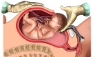Trẻ sinh mổ dễ mắc bệnh hen suyễn