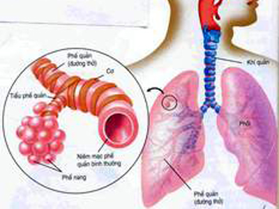 Bài thuốc cổ phương 1.500 “Tiểu thanh Long thang” gia giảm ngăn ngừa tái phát cơn hen nhờ tăng cường miễn dịch hệ hô hấp như thế nào?